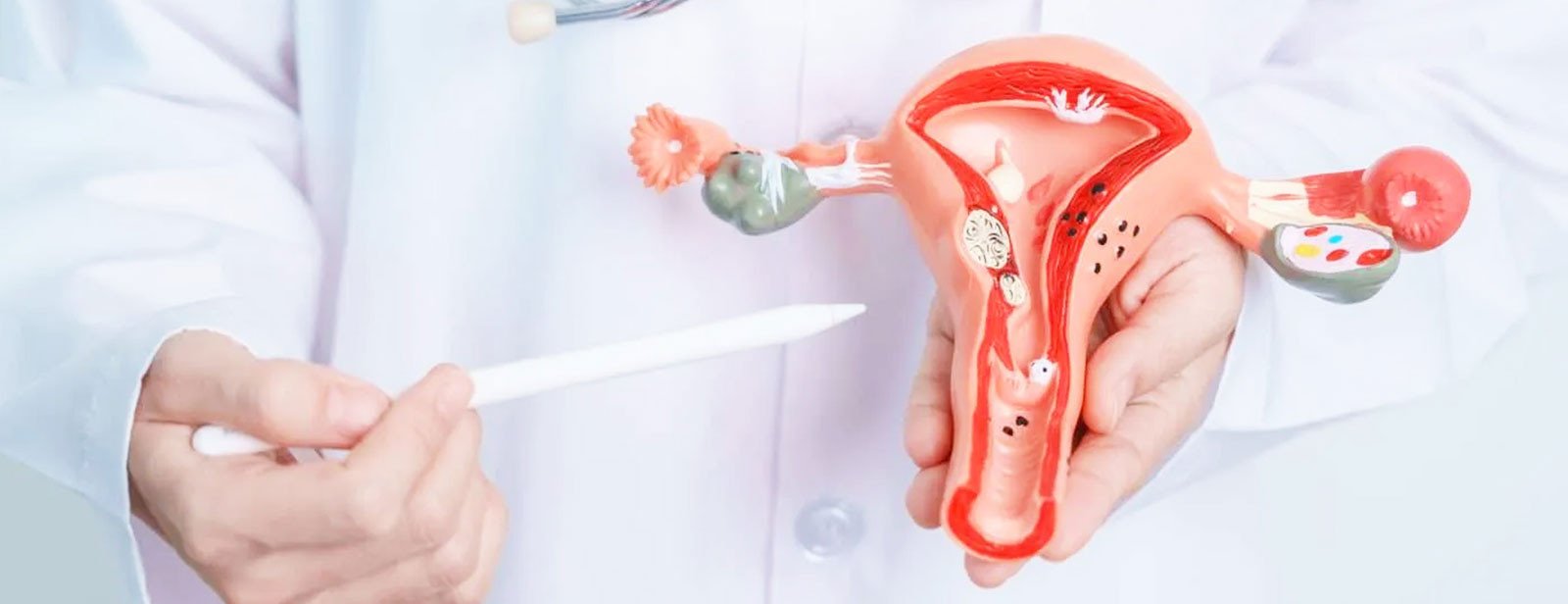 PCOD Treatment in Lucknow: Best Natural Solutions for Hormonal Balance